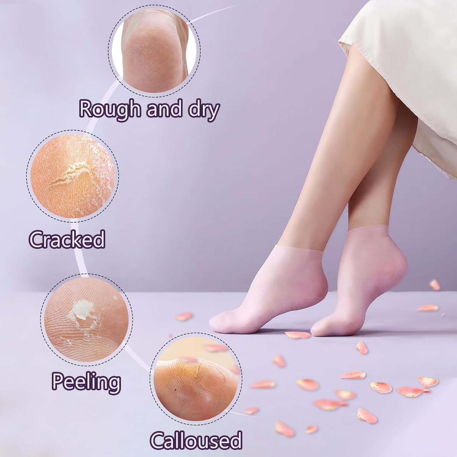 5 Pairs Silicone Socks for Dry Cracked Feet - Women's Moisturizing Foot Socks, Cracked Heel Treatment (5 Colors Assorted, Fits Up to Size 9)
